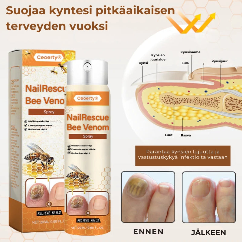 Crucial® NailRescue Bee Venom -kynsisuihke