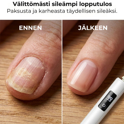 Sähköinen kynsiviila digitaalisella nopeudensäädöllä