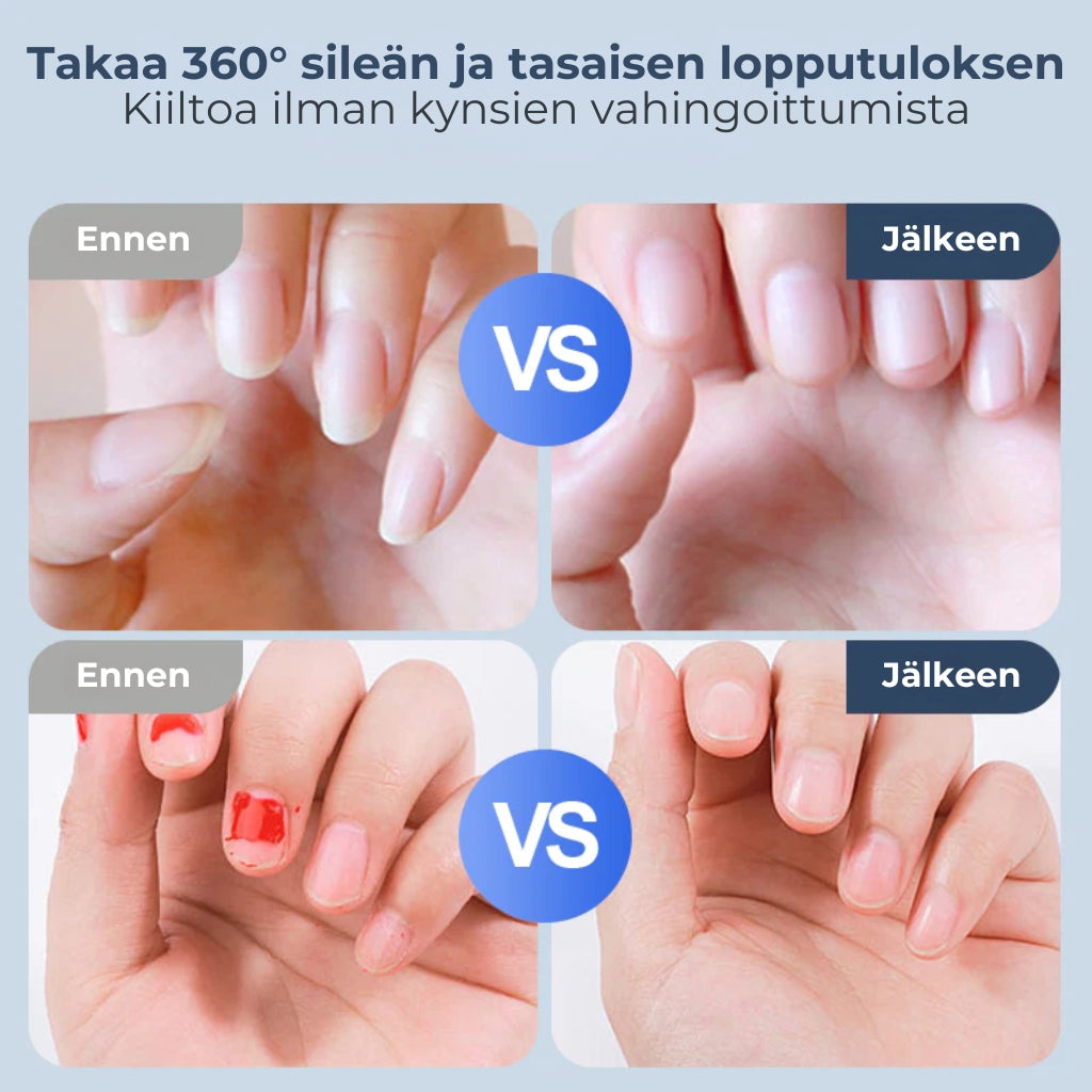 Automaattinen kynsiviila