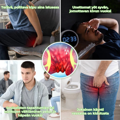 Nopeavaikutteinen yrttisuihke peräpukamien hoitoon