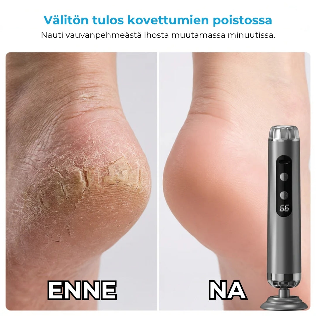 Elektroninen jalkaraspi, 5 nopeutta