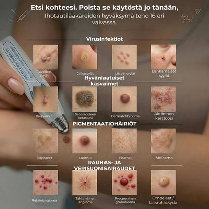 Kohdennettu roll-on syylien ja varsiluomien poistoon