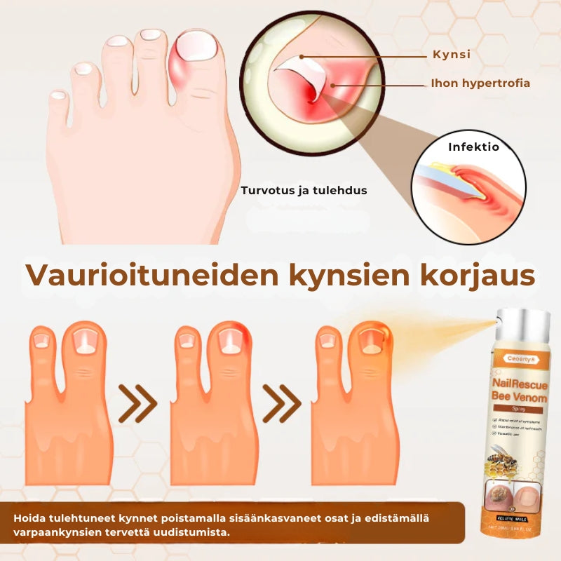 Crucial® NailRescue Bee Venom -kynsisuihke